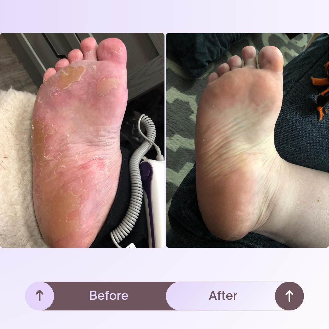 Efero Revive™ - Korean Exfoliating Foot Mask