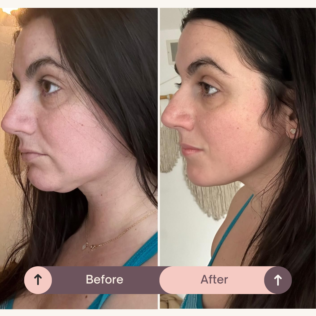 SlipOn™ - Natual V Shape Face Lift Belt